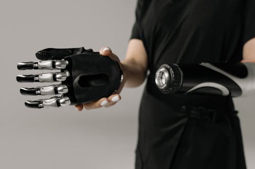 Person with Prosthetic Hand