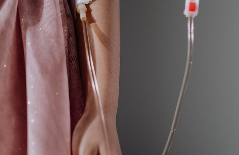 IV Drip at Derma Skin and Hair Solutions