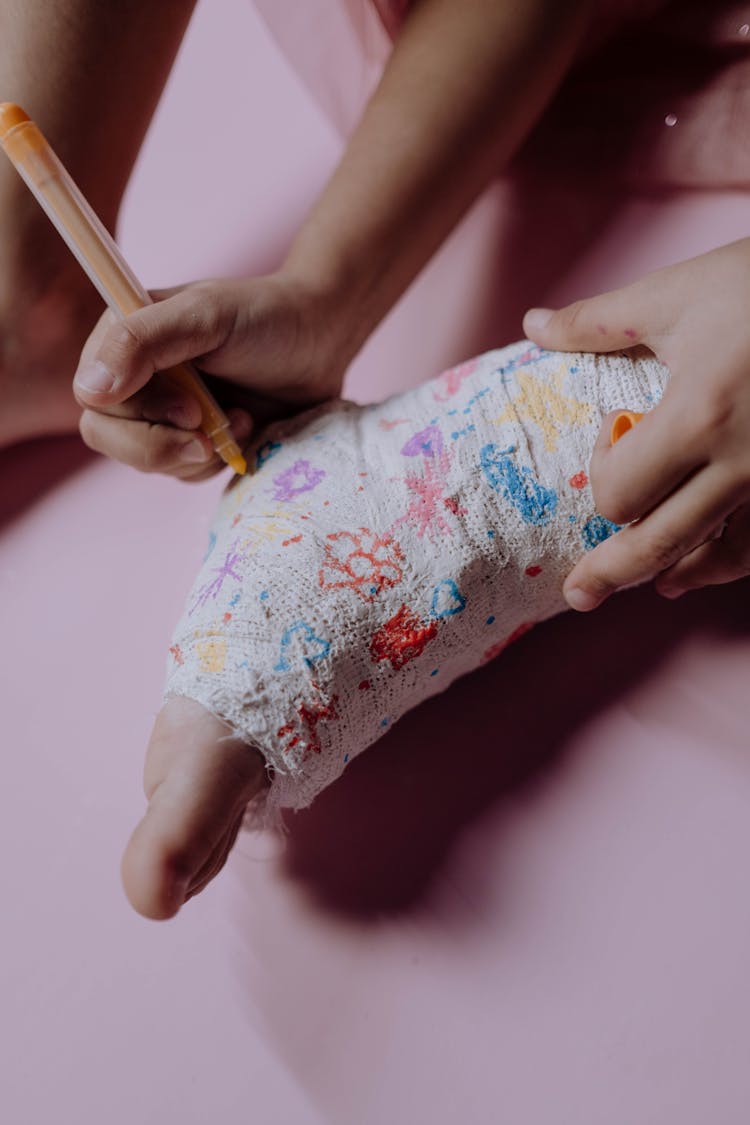 A Child Drawing On Orthopedic Cast