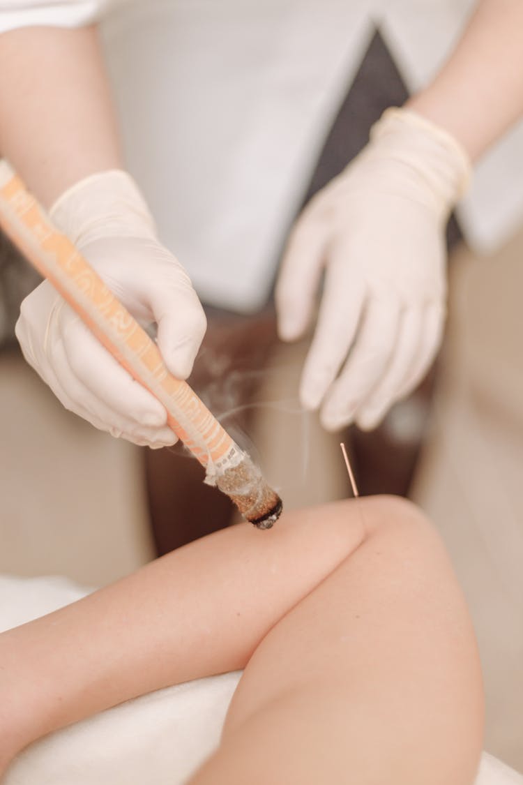 Needle Stuck On A Patient's Arm