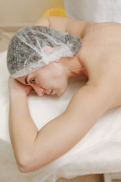 Woman Wearing a Hair Net With Acupuncture Needles