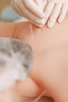 Detailed view of an acupuncture session showing needles being applied for alternative therapy.