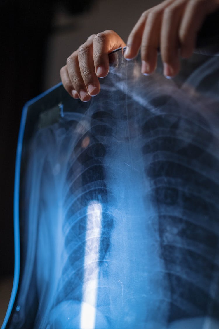 Person Holding X Ray Film