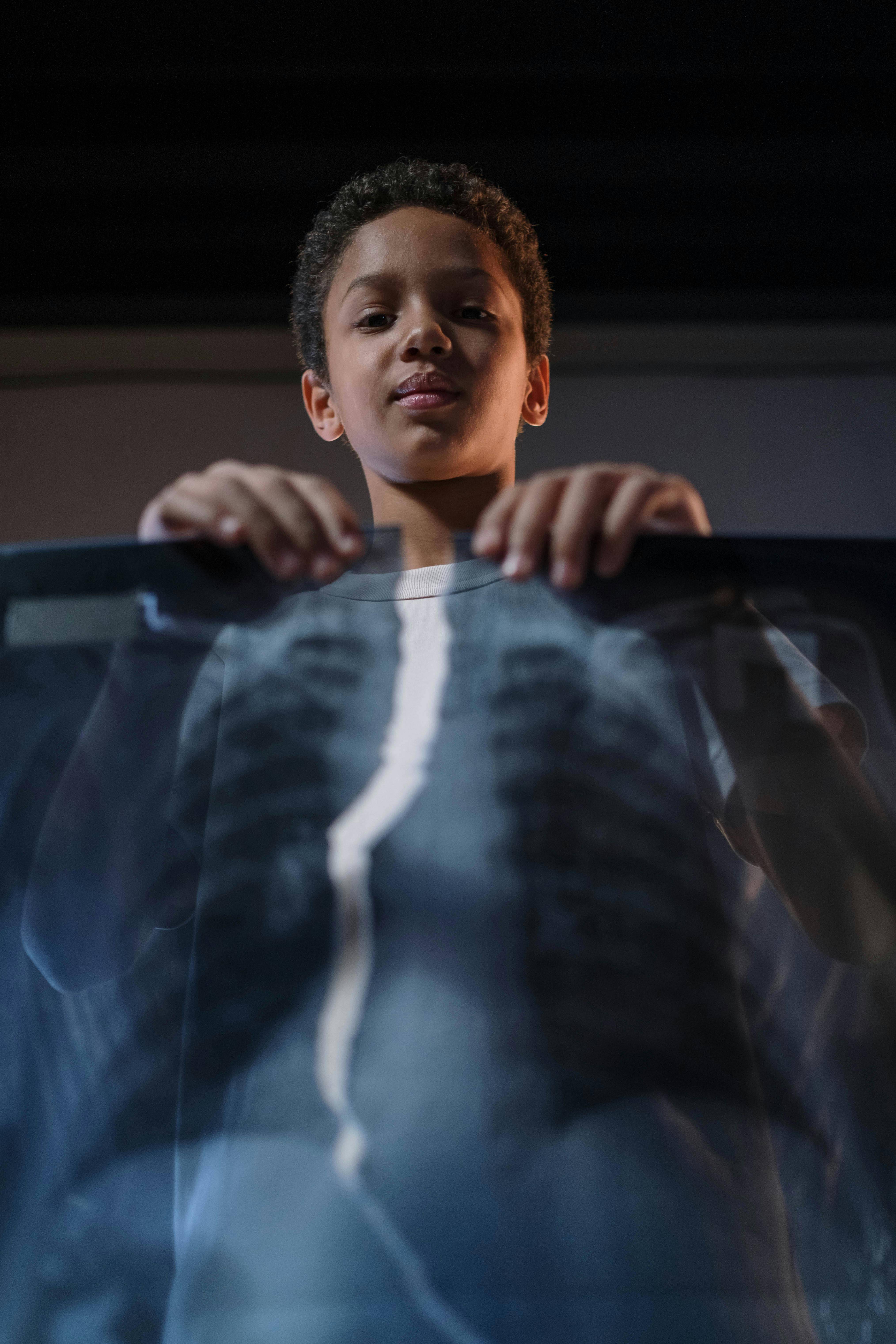 boy tearing a x ray film