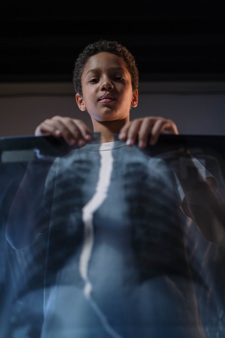 Boy Tearing A X-ray Film