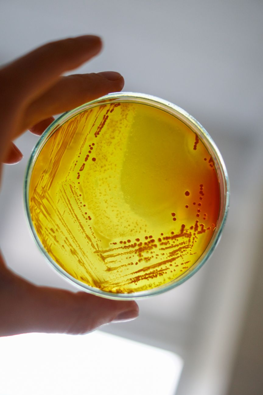 A researcher holding a petri dish, representing the shift from broad diversity claims to more specific microbiome measurements
