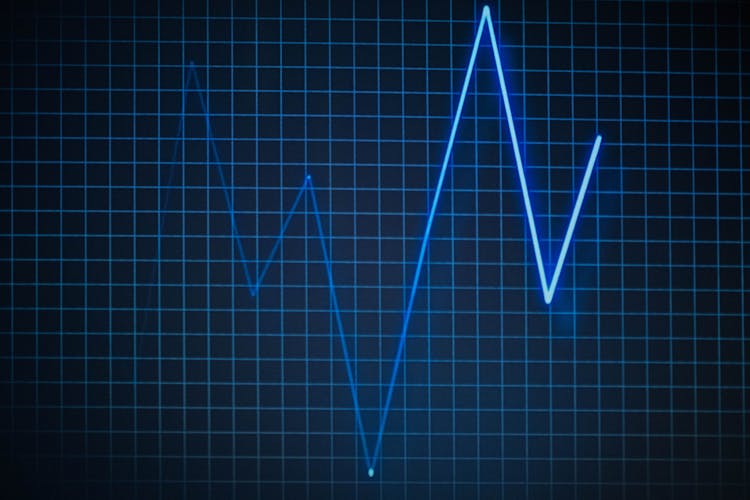 Graphic Illustration Of Heart Pulse Rate