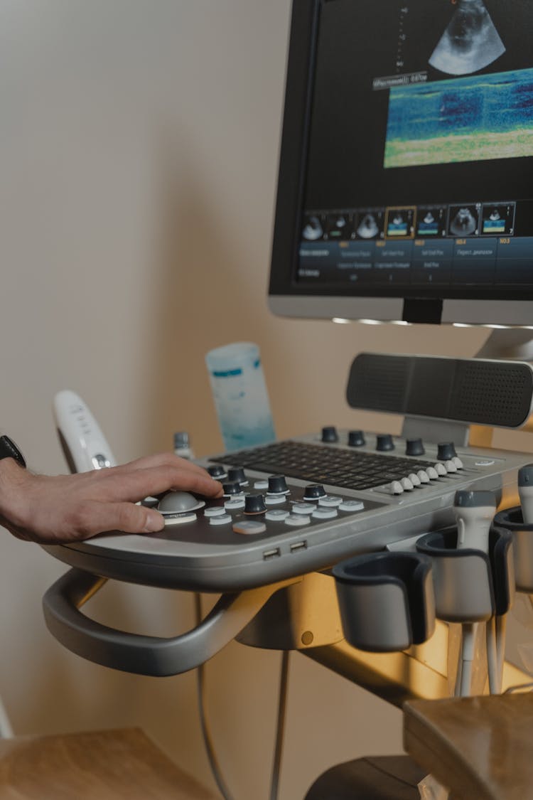 A Hand Operating The Ultrasound Machine