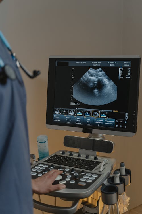 Free A Medical Practitioner Operating the Ultrasound Machine Stock Photo
