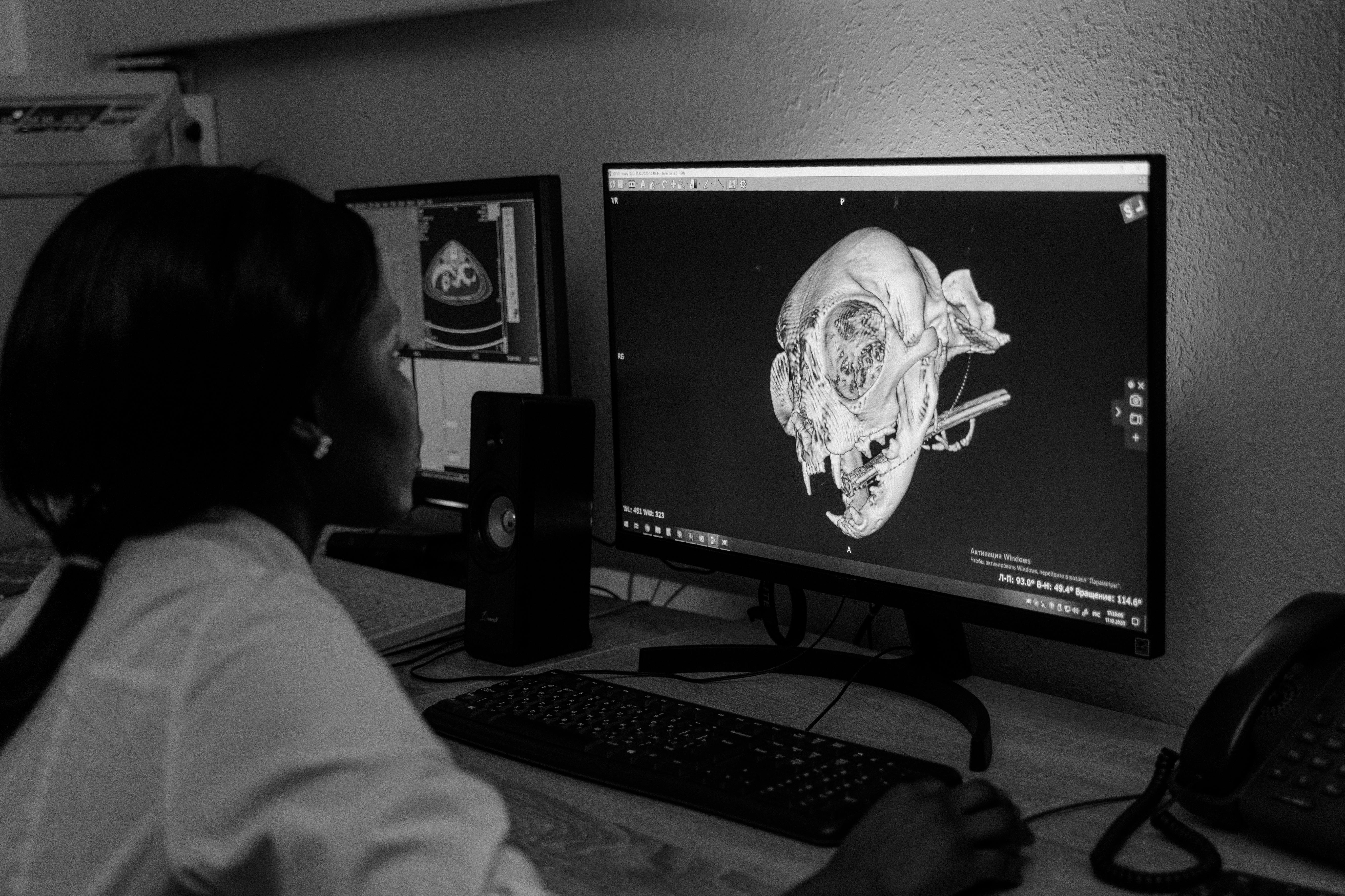 A Woman Looking at an X-ray Image on a Computer Monitor