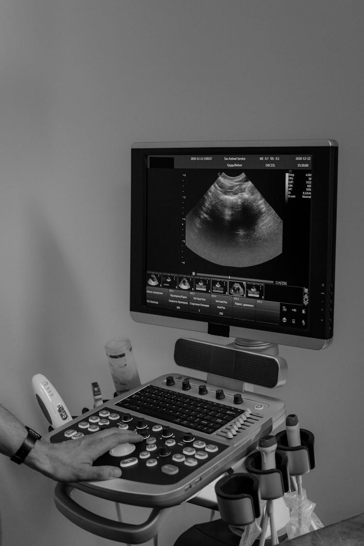 Grayscale Photo Of An Ultrasound Machine