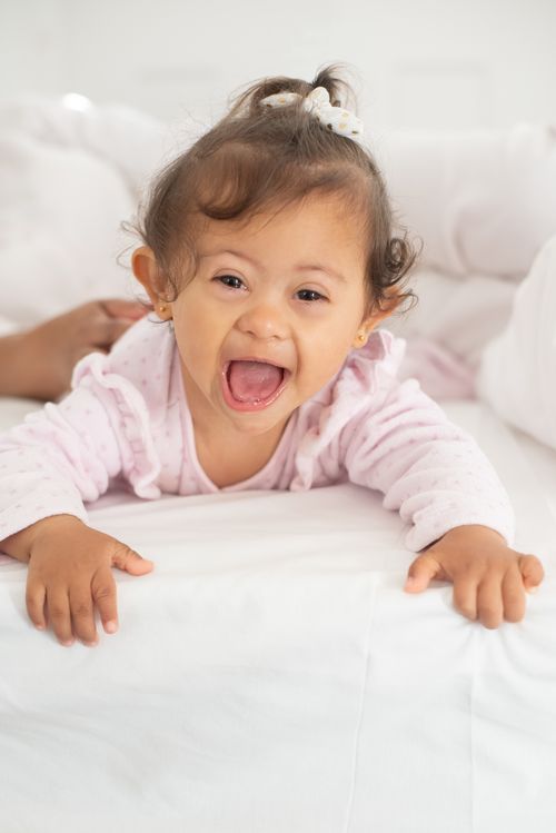 Free Adorable baby girl with Down syndrome happily lying on a bed indoors. Stock Photo