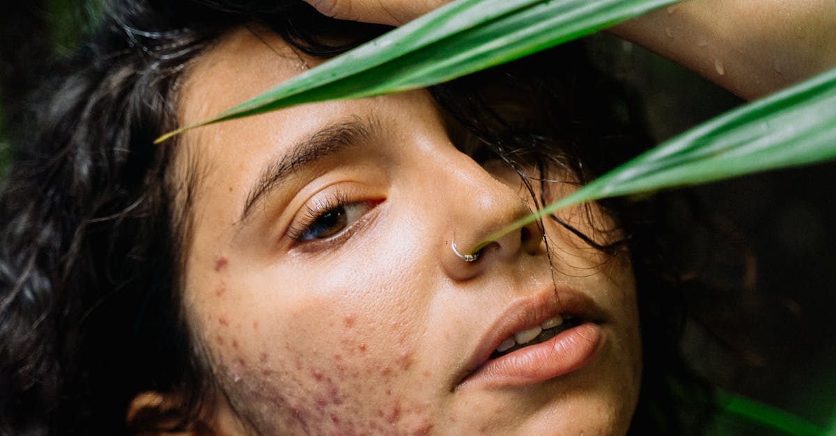 鼻中隔彎曲早期診斷 提升生活品質有撇步