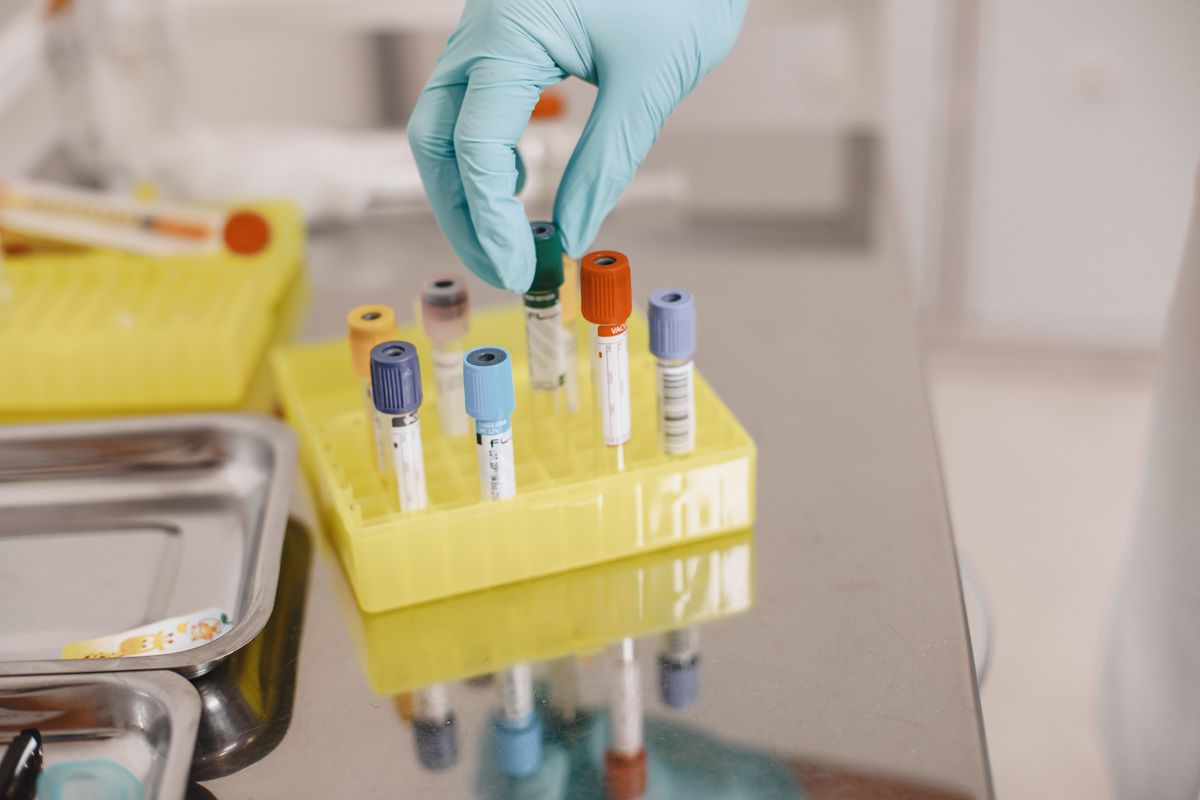 Gloved hand handling vials in a laboratory