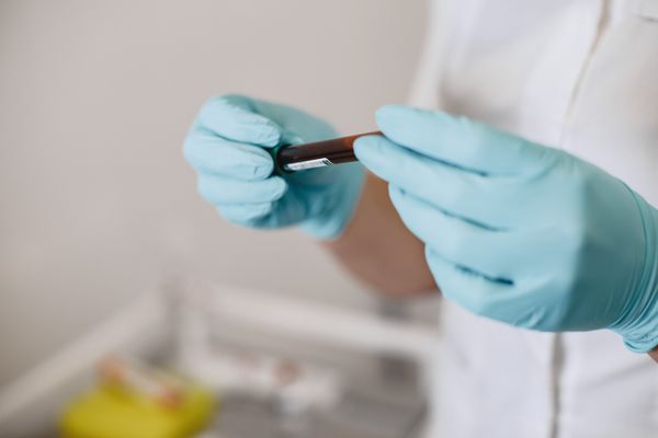 Lab technician holding blood sample - ABG measurement