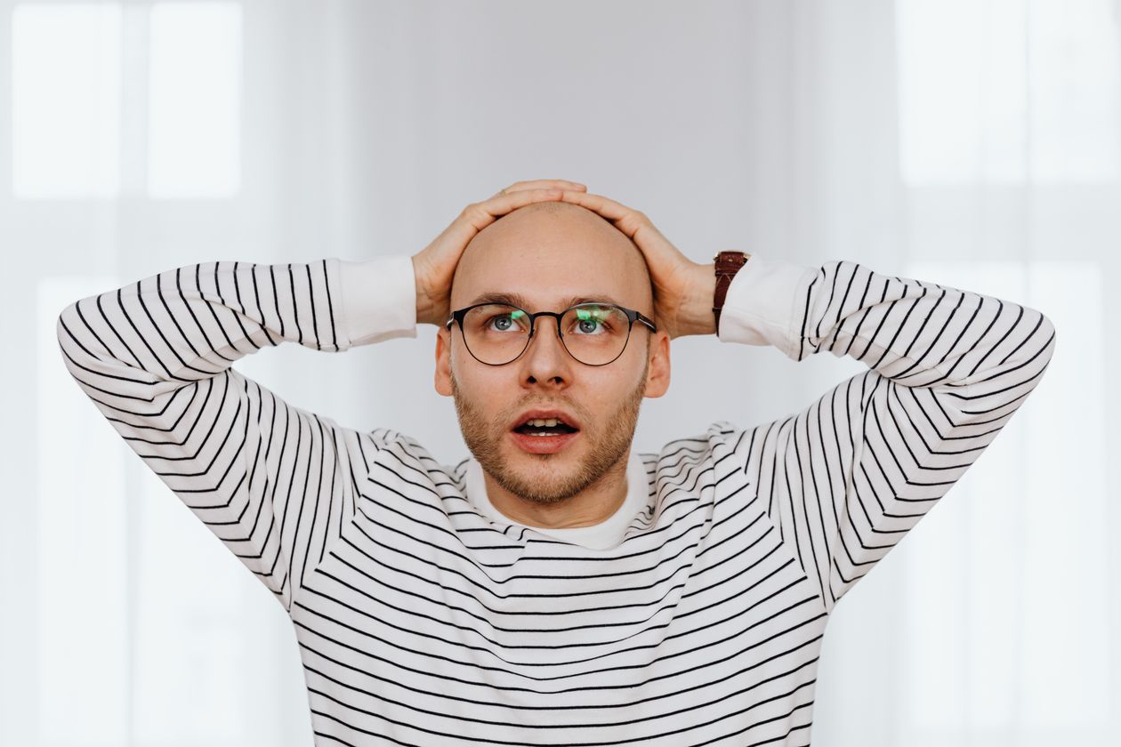 Man with hands on head concerned about hair loss