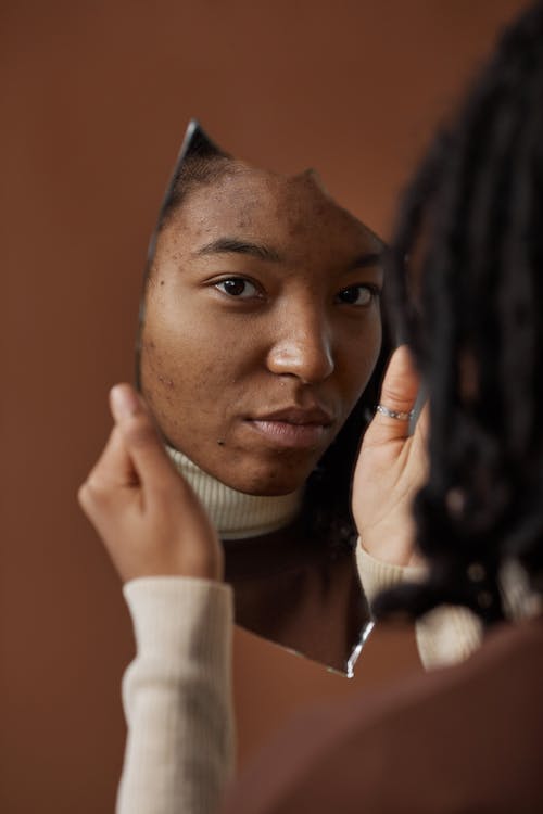 Immagine gratuita di acne, donna, donna afro-americana
