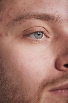 Extreme close-up of a man's face highlighting skin texture and acne with gray eyes.