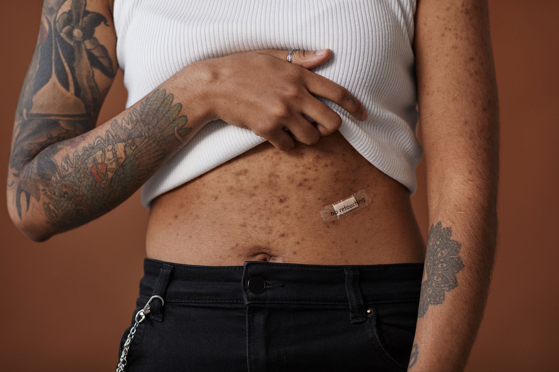 Papular Eczema: Understanding the Itchy Bumps