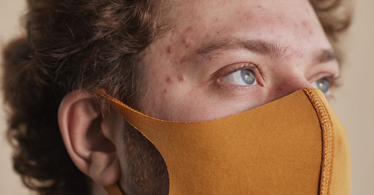 Detailed close-up of a man wearing a face mask, highlighting his acne and blue eyes. - Evidence evidence guide for zinc acne randomized trial