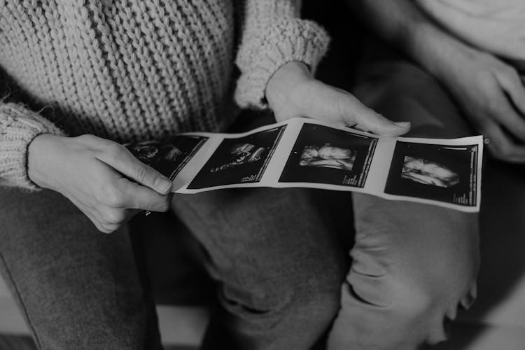 A Person Holding Ultrasound Images