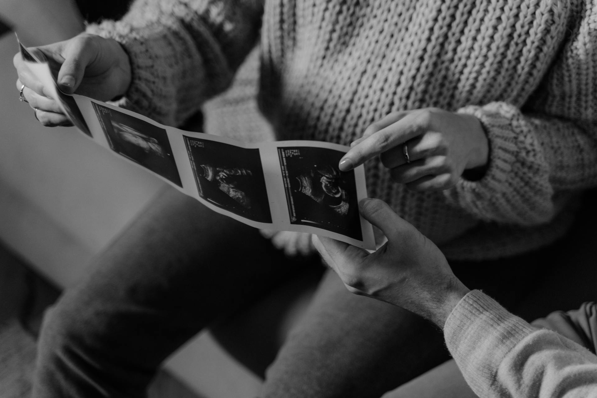 Une personne tenant une échographie