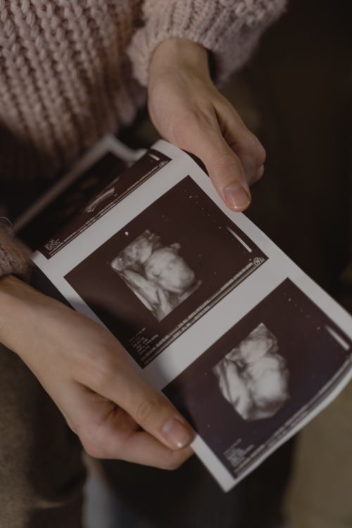 Free Hands gently holding ultrasound images, depicting a pregnancy moment. Stock Photo
