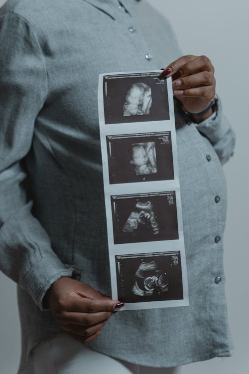 Free A Woman Holding Ultrasound Images Stock Photo