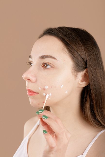 Do you have acne?