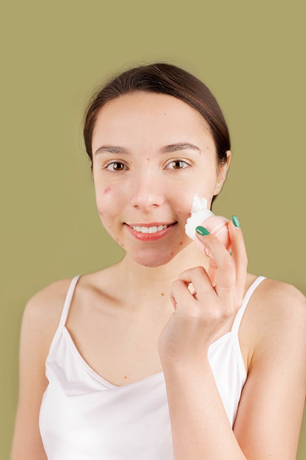 Teen girl with acne smiling and applying cream on her face