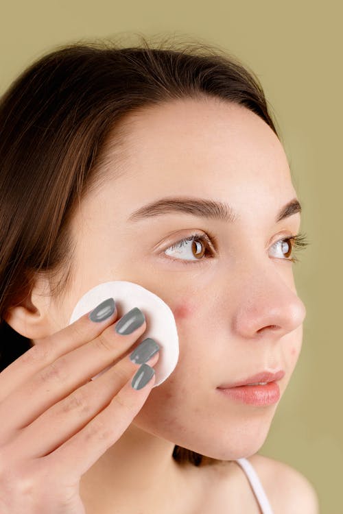 Free Kostnadsfri bild av acne, ansikte, ansiktsbehandling Stock Photo