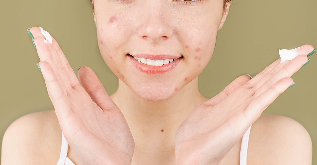 What is whey protein and acne