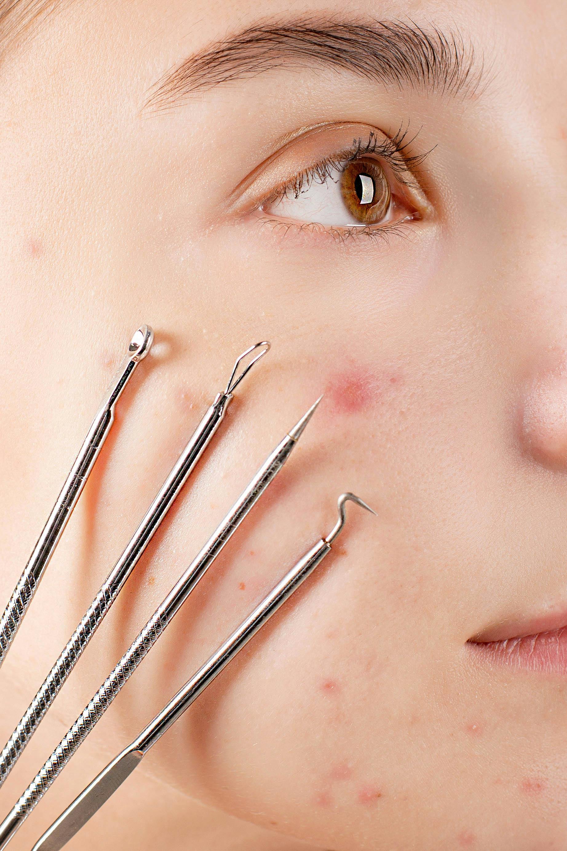woman s face with four skin extractor tools