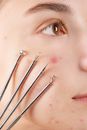 Woman's Face With Four Skin Extractor Tools