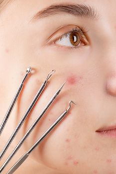 Woman's Face With Four Skin Extractor Tools