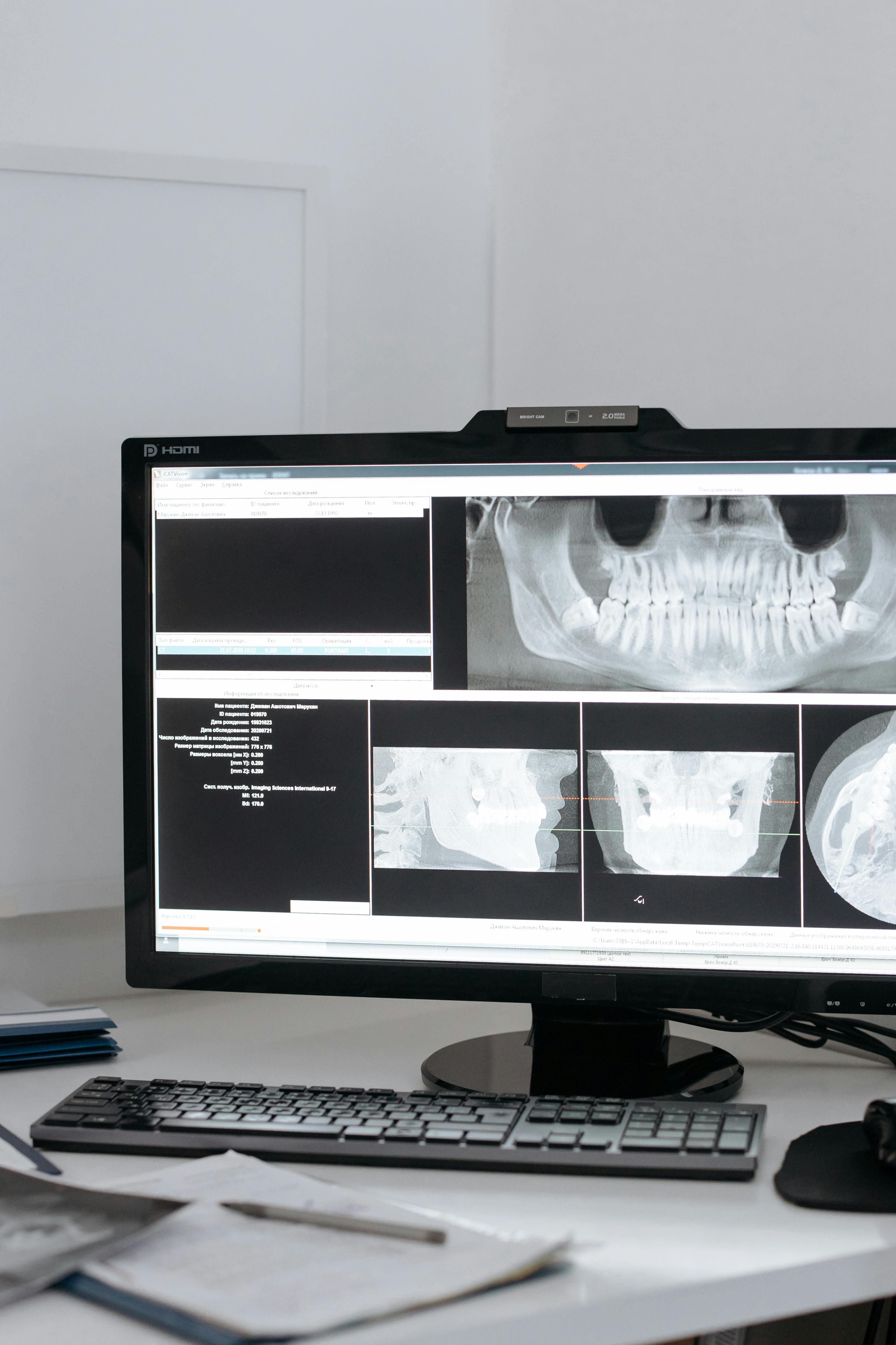 Foto profissional gratuita de aparelho, aparelhos, assistência médica ...