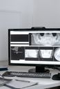 An X-ray Image of a Jawbone in the Computer
