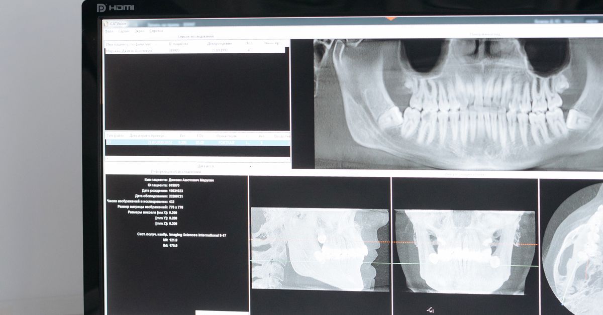Foto profissional gratuita de aparelho, aparelhos, assistência médica ...