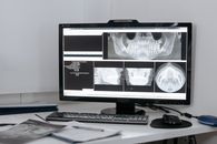 An X-ray Image of a Jawbone in the Computer