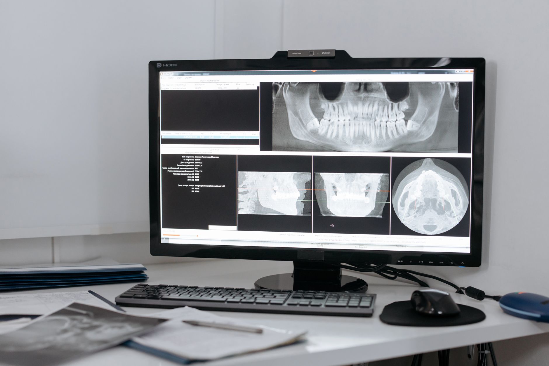 Modern dental clinic with technology and computer screens