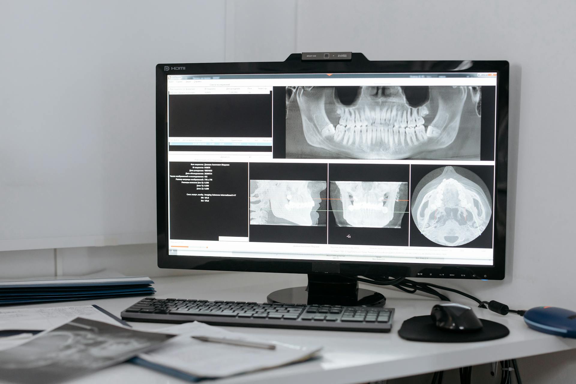 An X-ray Image of a Jawbone in the Computer