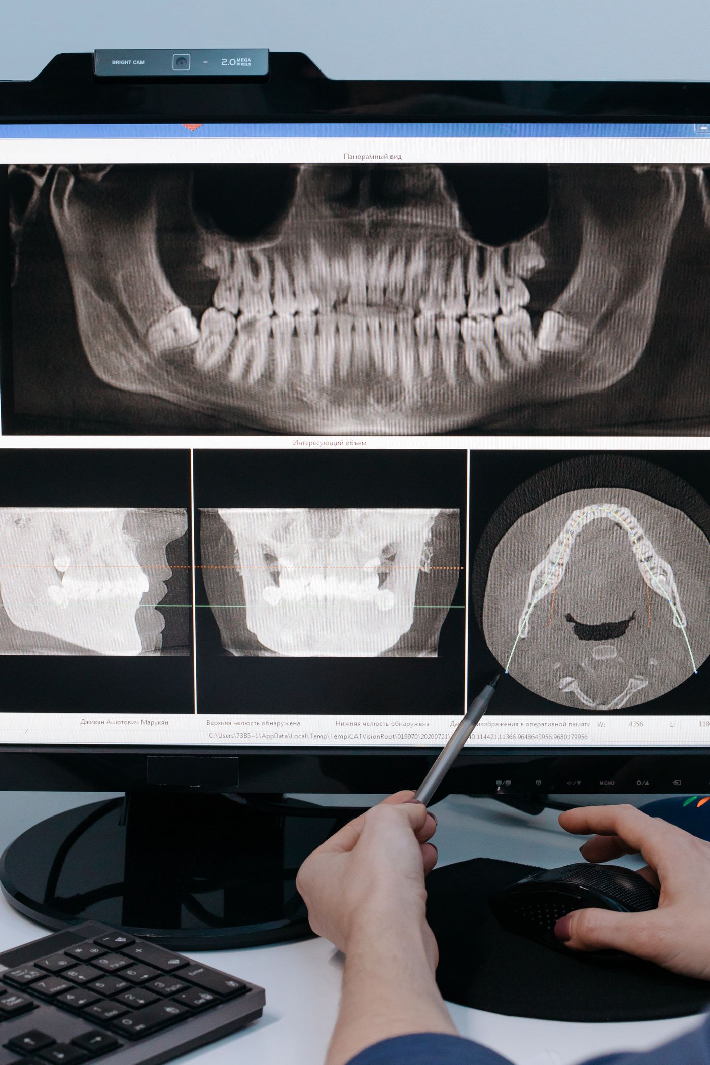 Panoramic dental X-ray