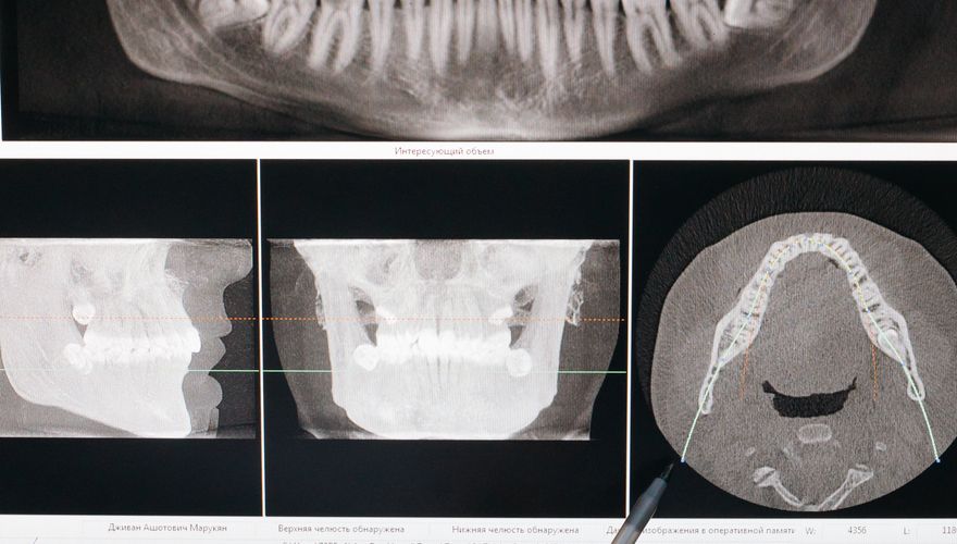 Dentist consulting with patient
