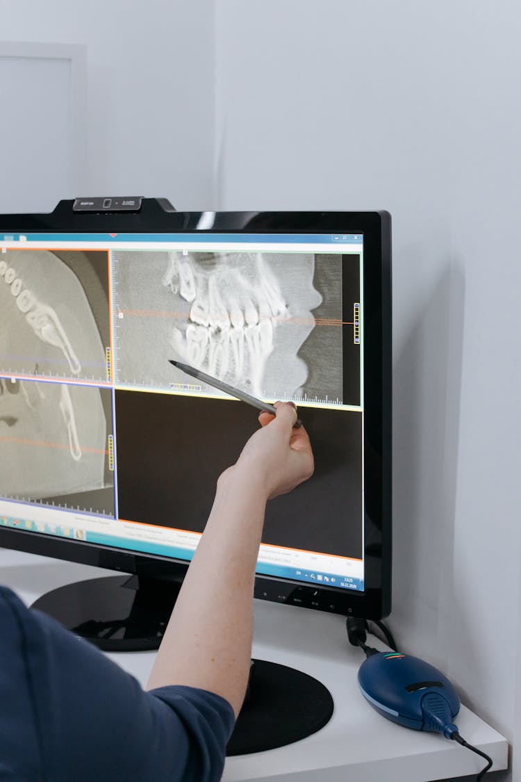 A Person Pointing On An Xray Image