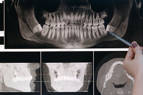 бесплатная Бесплатное стоковое фото с зубы, крупный план, лечение зубов Стоковое фото