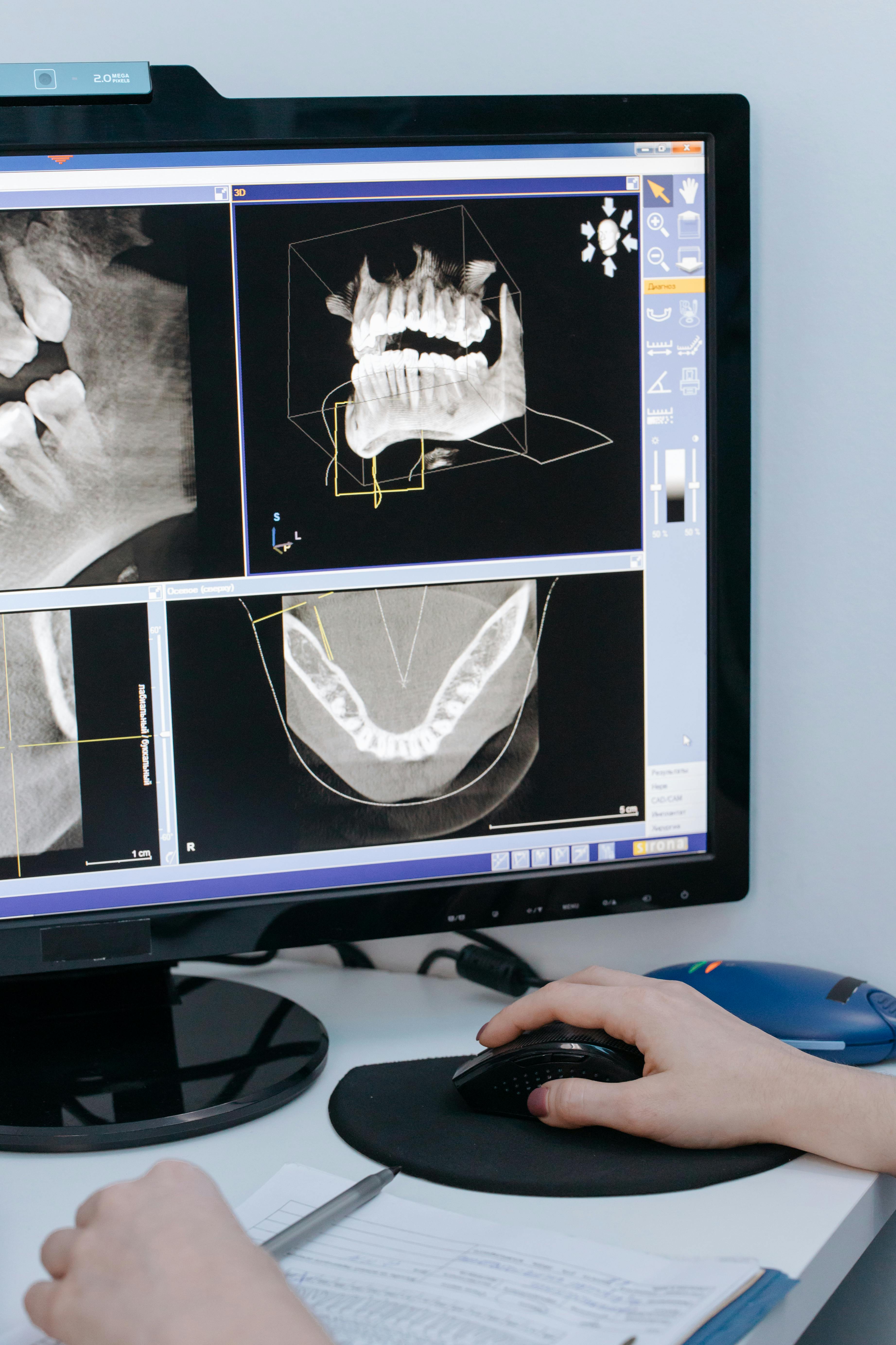 xray image of teeth on the screen