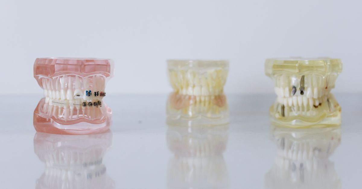 Prednisolone Dent Sagesse : Guide Dosage