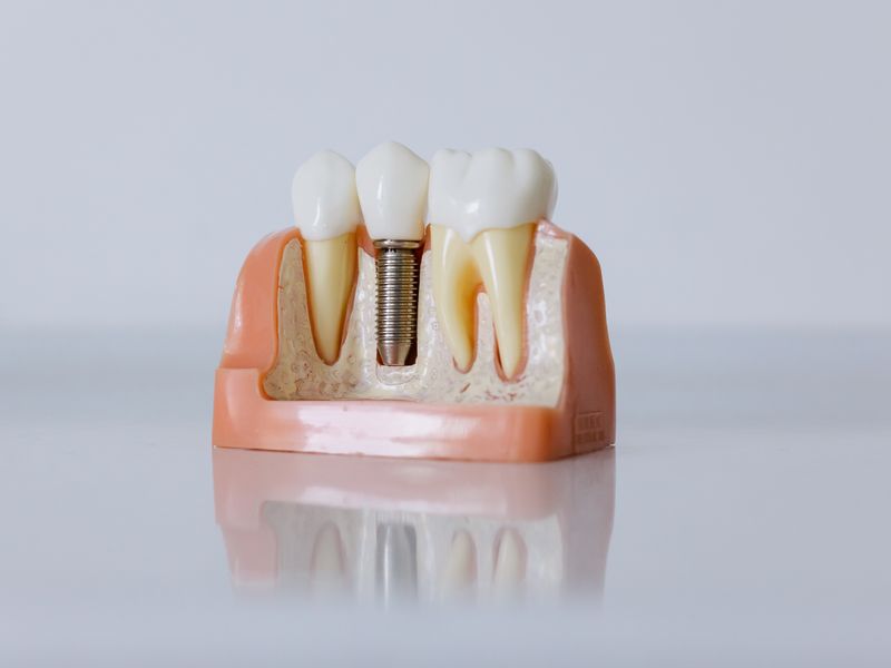 So sánh các thương hiệu phổ biến và giá bán