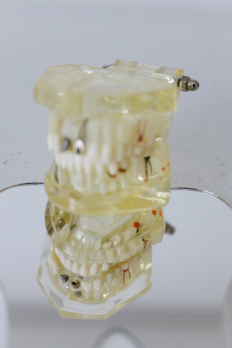 Close-Up Shot Of Dentures Stack Together