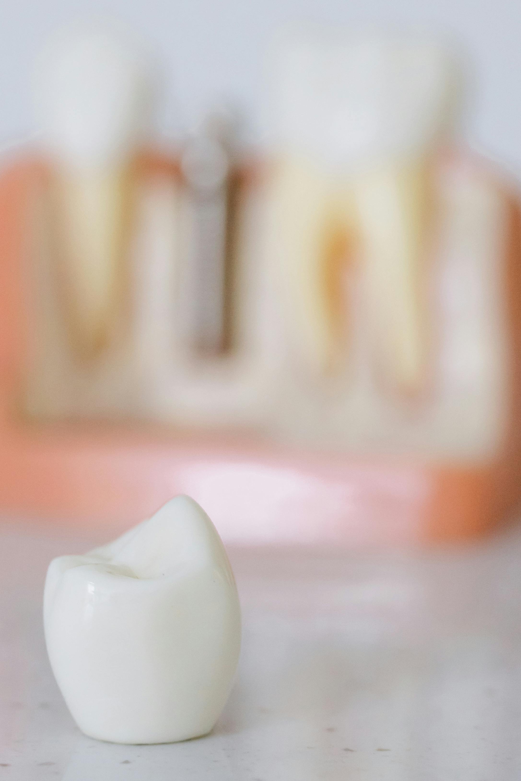 close up photo of an implant tooth